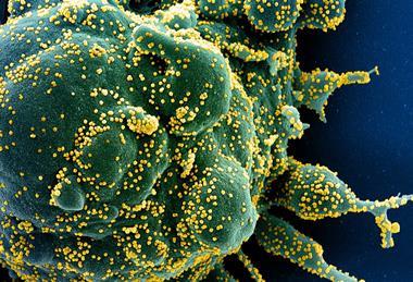 SARS-COV-2_virus (2)