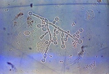Candida_albicans_1964