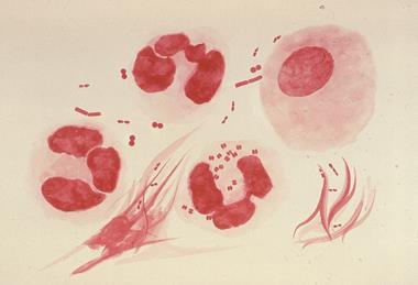 Neisseria_gonorrhoeae_PHIL_3693_lores