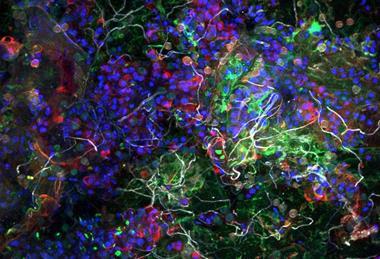 Low-Res_PM_Biofilm ©Thomas Neu UFZ