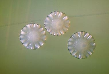 Actinomyces_spp_01