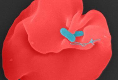 Low-Res_Bartonella bacilliformis_1000x1000c_Juergen_Berger_MPl_Biology_Tuebingen