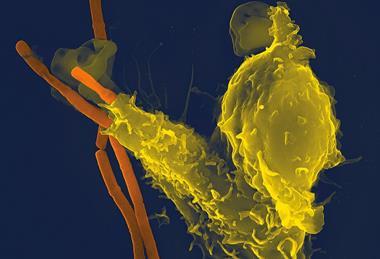 Neutrophil_with_anthrax_copy