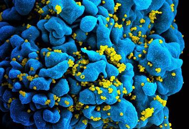 HIV-infected_T_cell_(6813384933)