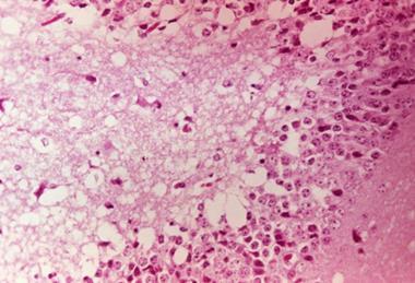 Venezuelan_equine_encephalitis_virus