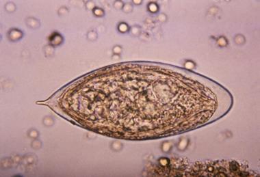 Schistosoma_haematobium_egg_4843_lores