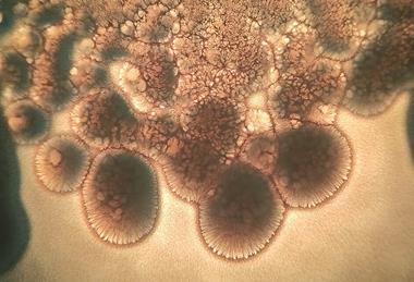 Beautiful_Bacillus_subtilis_bacterial_growth_under_the_microscope_06