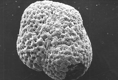 Foraminifera-diagenetic-altered_hg