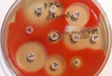 Serratia_marcescens_-_antibiogram