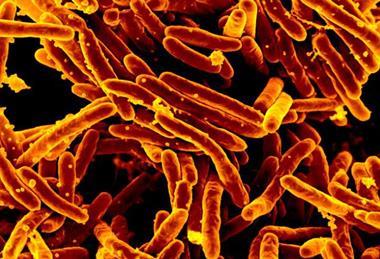 Mycobacterium_tuberculosis_MEB_(1)