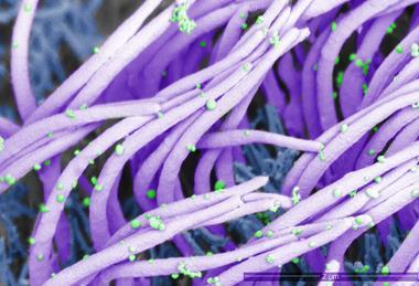 Influenza_A_virions_on_cilia_human_nasal_epithelium_SEM_high_magnification