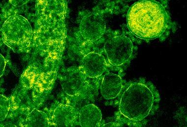 pexels-cdc-library-3992943