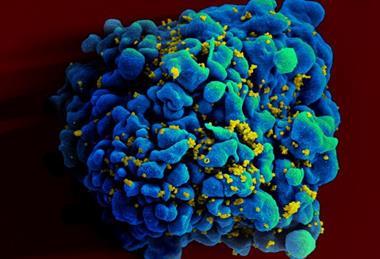 HIV-infected_H9_T_cell