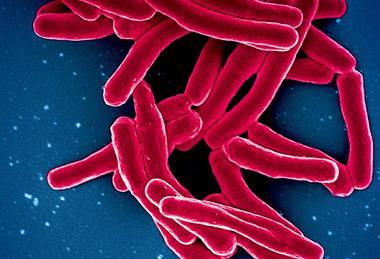 Mycobacterium_Tuberculosis_Bacteria,_the_Cause_of_TB_(52765697337)