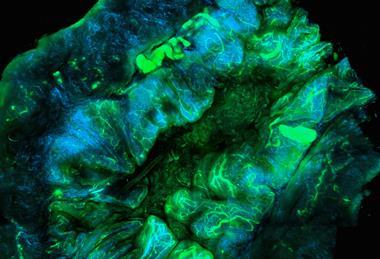 national-cancer-institute-A6MF_mnQ3ow-unsplash