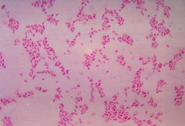 BacteroidesFragilis_Gram