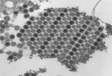 Chikungunya_virus_particles-PHIL-17369