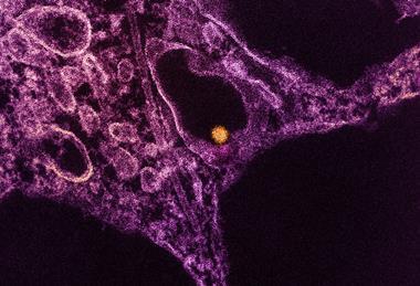 West_Nile_Virus_Particle