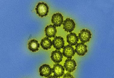 H1N1_Influenza_Virus_Particles_(8411599236)