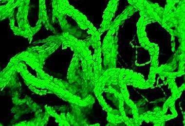 Bacteria forming cables that tangle together