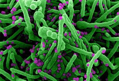Novel_Coronavirus_SARS-Cov-2_(50010217143)