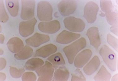 Plasmodium_falciparum_in_Red_Blood_Cells (1)
