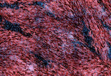 Low-Res_HF_MPXV_semen_Torbica_et_al_EmergingMicrobesInfections_2026