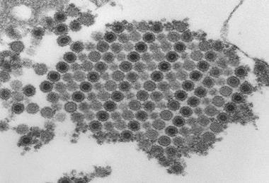 Chikungunya_virus_particles-PHIL-17369