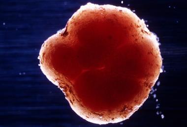 CSIRO_ScienceImage_2483_Rhizobium_bacteria