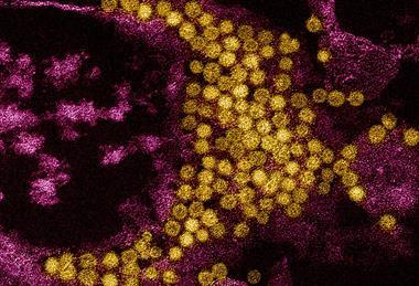 Enterovirus_D68_Virus_particles_colorized_transmission_electron_micrograph_-_211