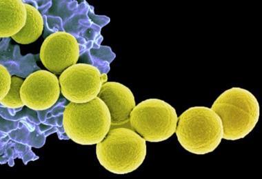 Methicillin-resistant_Staphylococcus_aureus_Bacteria