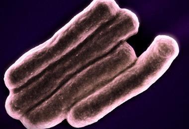 Mycobacterium_Tuberculosis_Bacteria,_the_Cause_of_TB_(52766722758)
