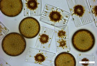 Marine_diatoms.tif