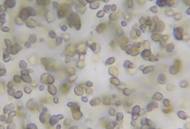 Microscope_view_of_Candida_albicans_20200228_134207_04