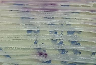 Candida_parapsilosis_ATCC_22019_growth_on_Chromagar