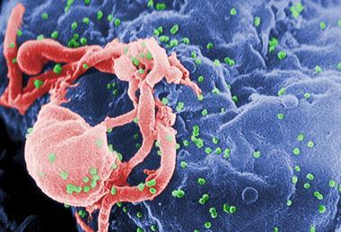 HIV-budding-Color
