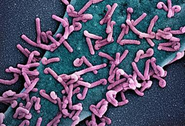 Marburg_virus_outbreak