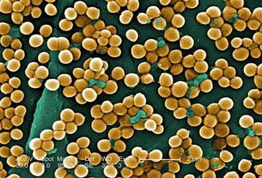 CDC-10046-MRSA