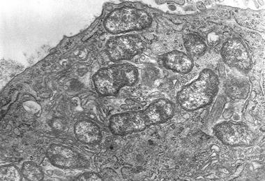 Orientia_tsutsugamushi