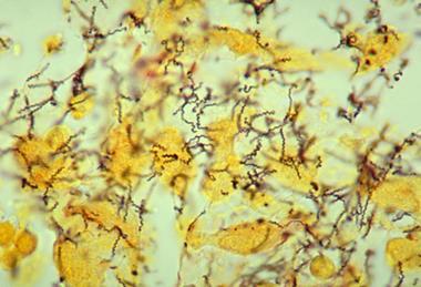 Treponema_pallidum_01