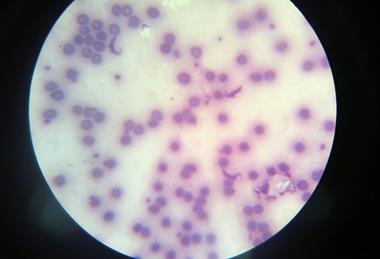 Trypanosoma_cruzi