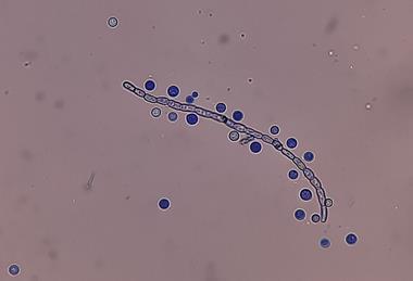 LPCB_Mount_of_Cryptococcus_growth_on_SDA_microscopic_footage