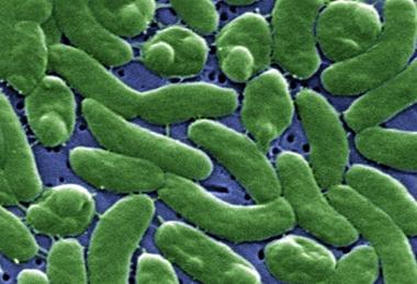 Vibrio_vulnificus_01