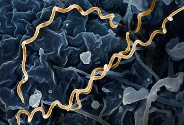 Treponema_pallidum_Bacteria_(Syphilis)