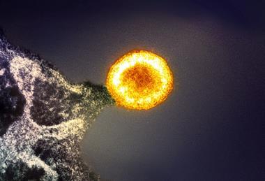 HIV-1_Virus_Particle_(52532147267)