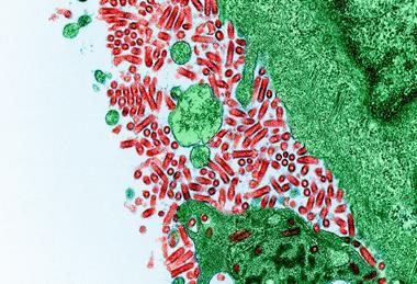 Rabies_Virus_(51706598561)