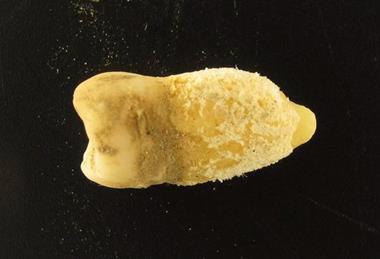 Low-Res_bolivia_2730_tooth02