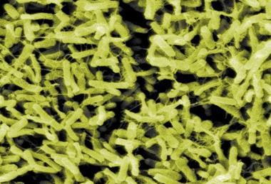 ClostridiumDifficile