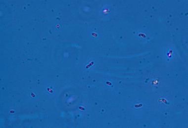 Geobacter_sulfurreducens.TIF