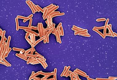 Mycobacterium_Tuberculosis_Bacteria
